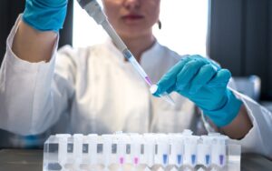 Why Sample Integrity Matters in Modern Urine Testing Programs